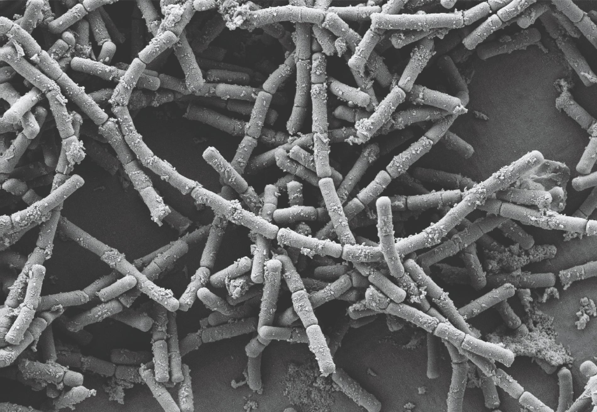 L. Crispatus from a microscopic image