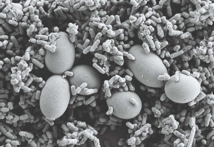 Probiotic strains from a microscopic view