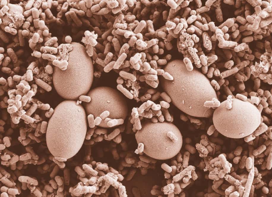 Microscope view of strains